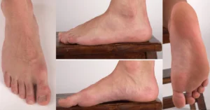 The Importance of Angles in Feet Photography